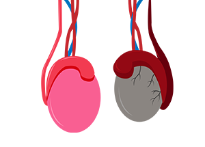 Doenças dos Testículos