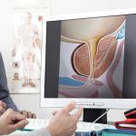 Urolift e iTIND: Técnicas Minimamente Invasivas para Tratar a HPB